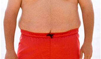 Breast reduction surgery for men: are you a good candidate?